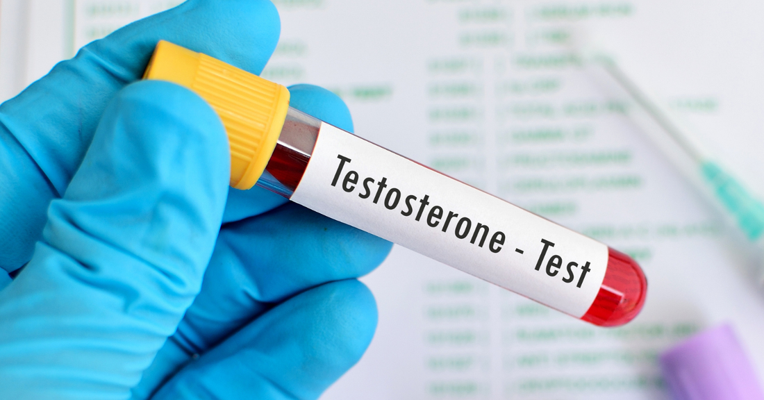 Your Testosterone Is Dropping — Here's What That Actually Means